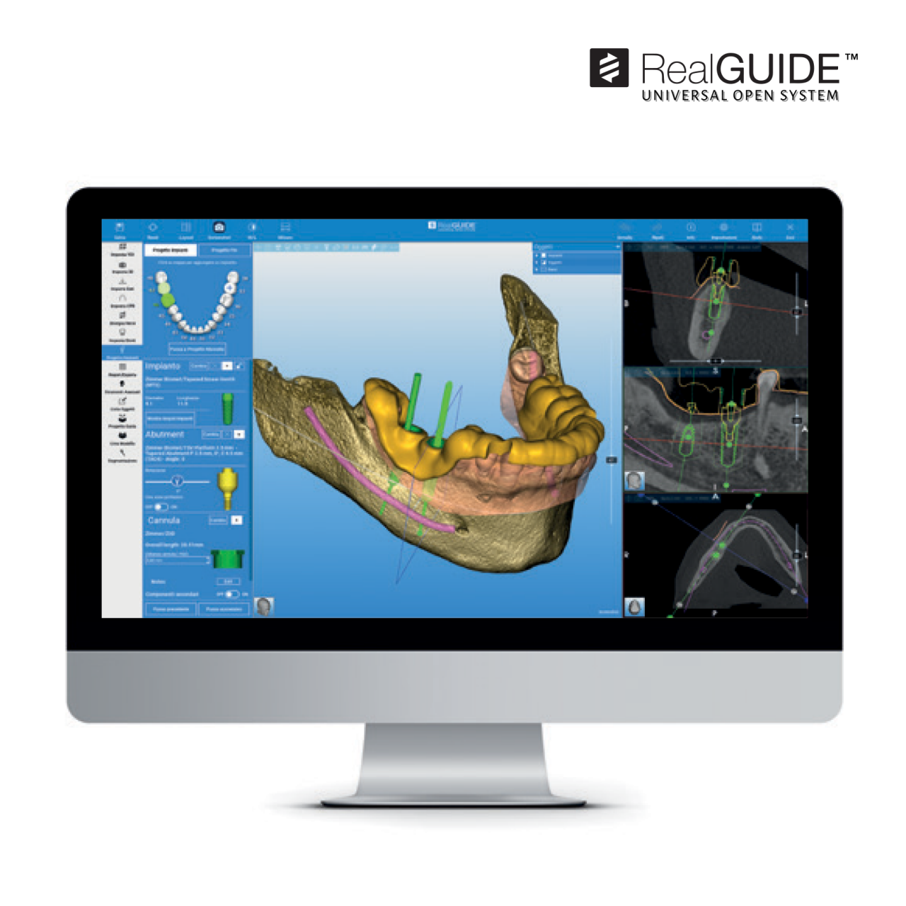 RealGUIDE™ Software Suite Computer Screen